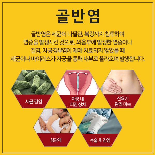 골반염 원인 및 통증 증상 검사 후 치료 방법 까지 3