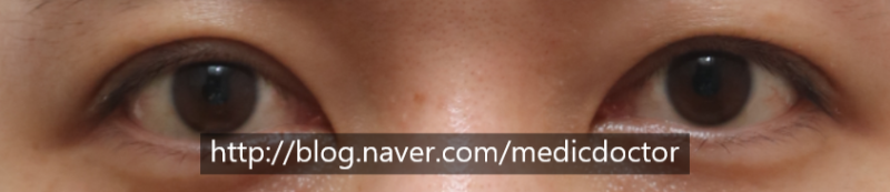 Revision Case 4