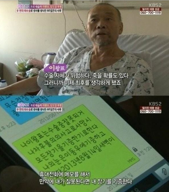  이왕표 이동우에 눈 기증...
