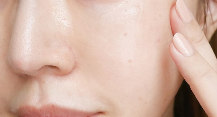 기미순치 크림이 얇아져요. 3