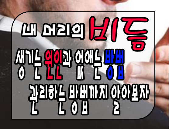 비듬제거방법 알아두셔요 3