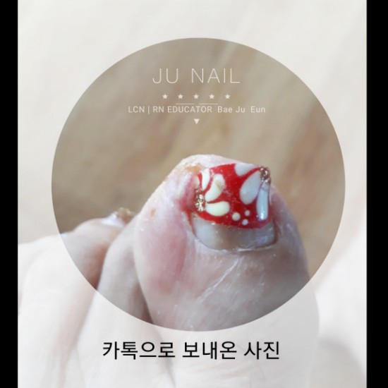 우리엄마발톱이파고들었어요ㅠㅠ/분당용인수원수지보정동백죽전동/주네일/파고드는발톱전문네일샵 우리엄마발톱이파고들었어요ㅠㅠ/분당용인수원수지보정동백죽전동/주네일/파고드는발톱전문네일샵
