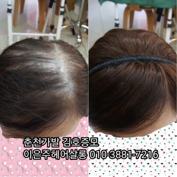  춘천가발 김호증모 두피에 무리없이 간편한착용 머리띠가발 직접 만들어 드리는 이은주헤어살롱으로 오세요~^^