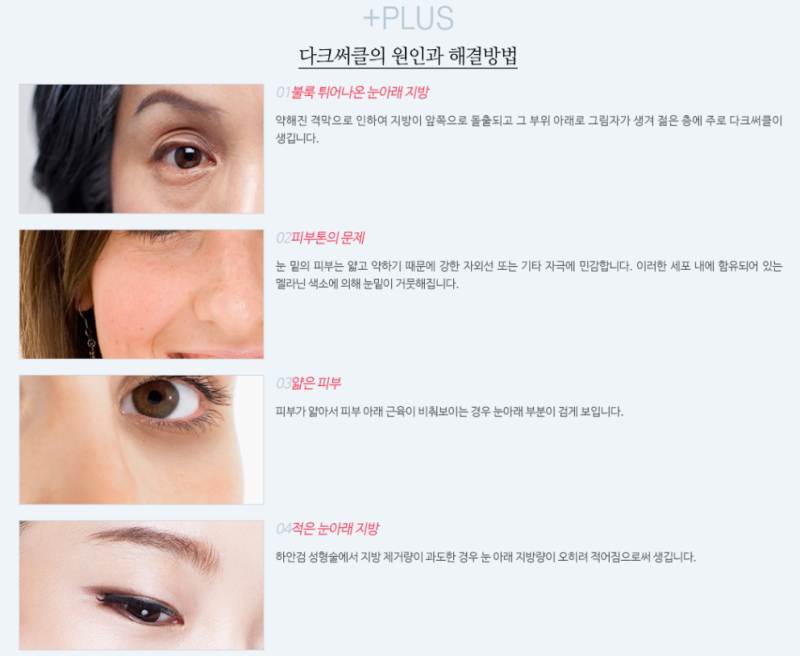 다크써클로 고민하시는 분들, 여기를 봐주세요!!