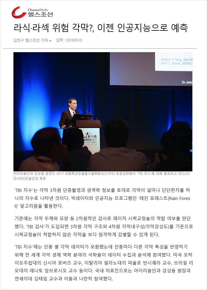 스마일라식라섹 안전성, 인공지능 기술로 향상