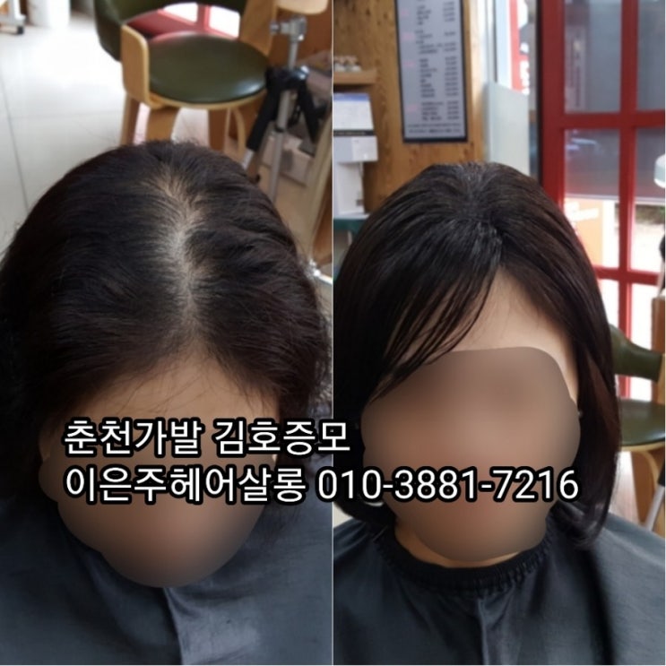  춘천가발 김호증모 여자 가르마가발 탑가발 정수리가발 맞춤수제피스 주문제작 이은주헤어살롱에서 합니다~^^
