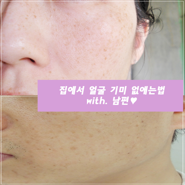 기미제거법 남성화장품추천 원진이펙트 멜라리스 기미제거법 남성화장품추천 원진이펙트 10