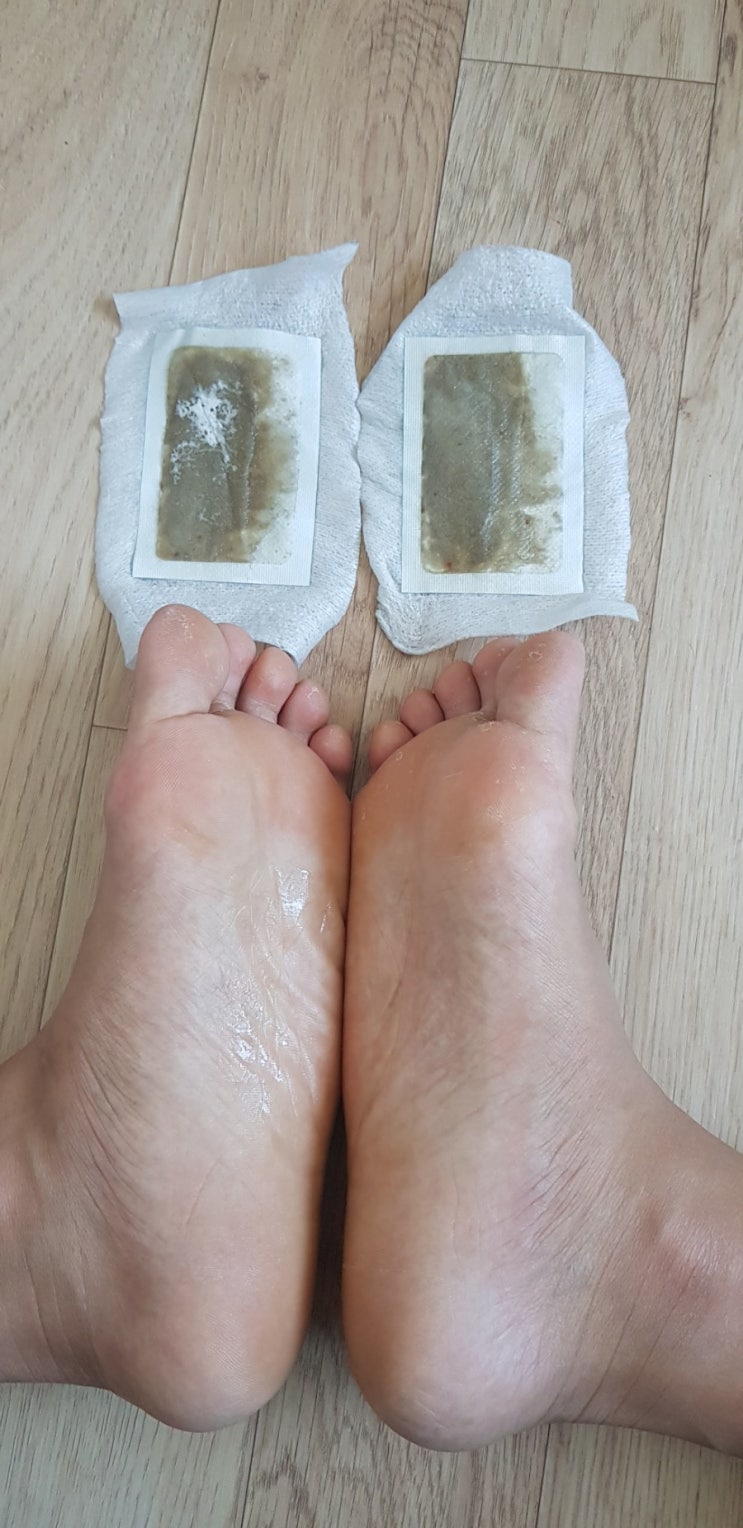  인스타 소장각 힐링패치 사용 후기