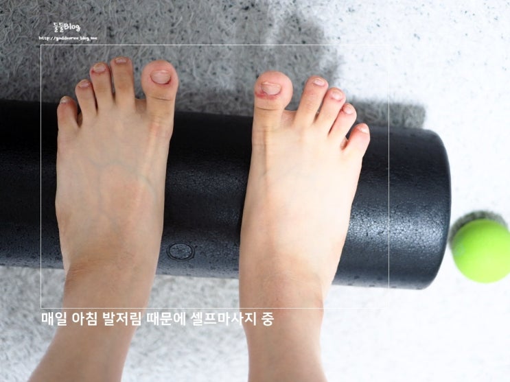 메디테라피 힐링패치 다리 붓기 해결 될까요? 리얼 솔직후기 들려드림