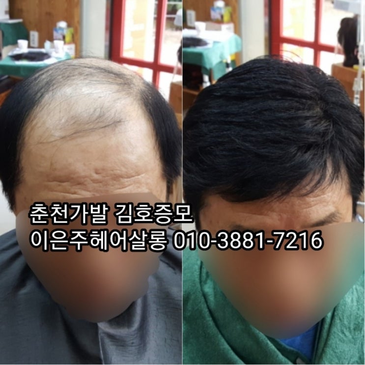  춘천가발 김호증모 춘천가발전문점 이은주헤어살롱에서 추석맞이 타사가발도 관리받고 갑니다~^^