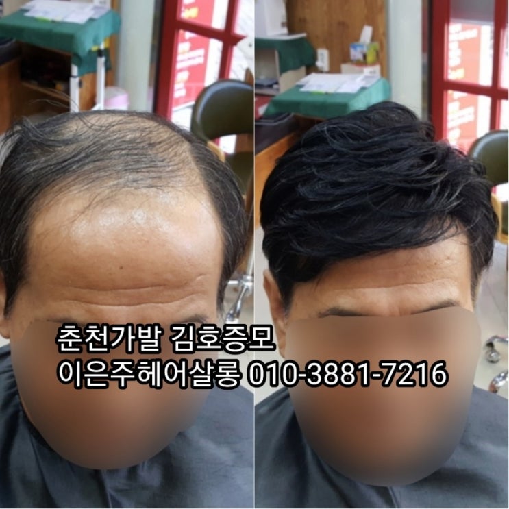  춘천가발 김호증모 남자맞춤가발 관리는 춘천가발전문점 이은주헤어살롱에서 합니다~^^