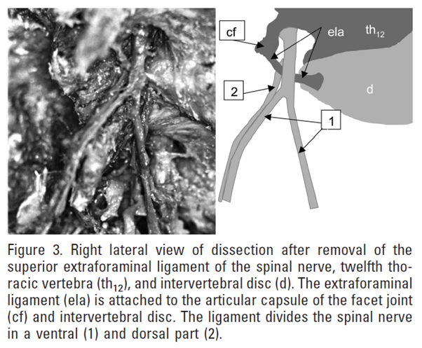 [척추] 요추 추간공외인대 (Lumbar extraforaminal lig.) : 네이버 블로그