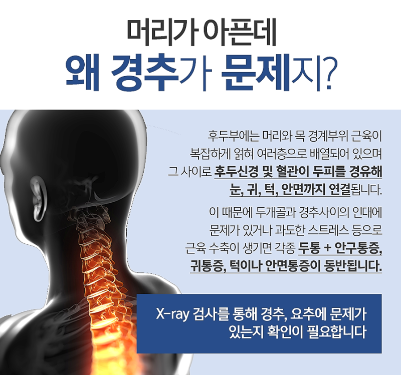 “목디스크 두통의 원인과 치료법”