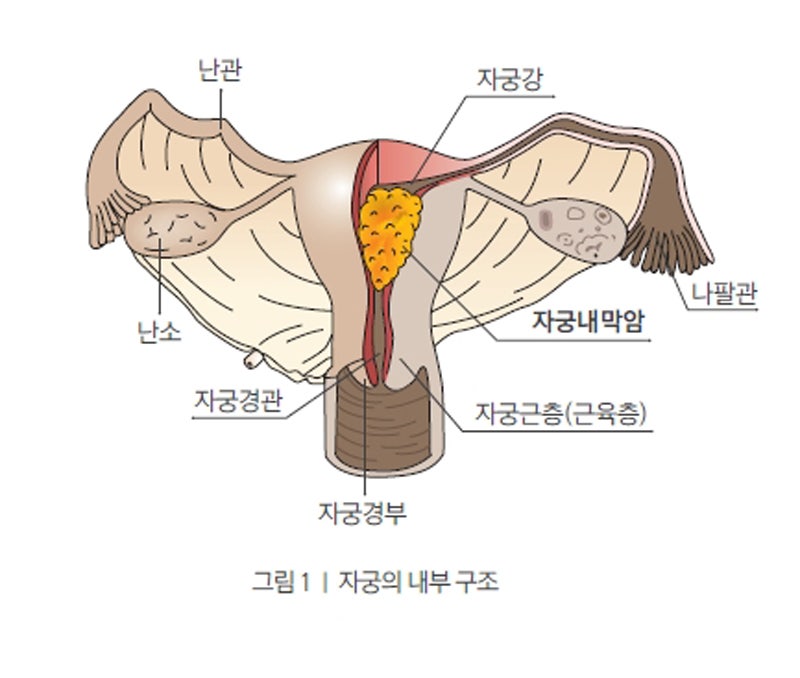 자궁암의 초기 증상이 의심되는 것은? 7