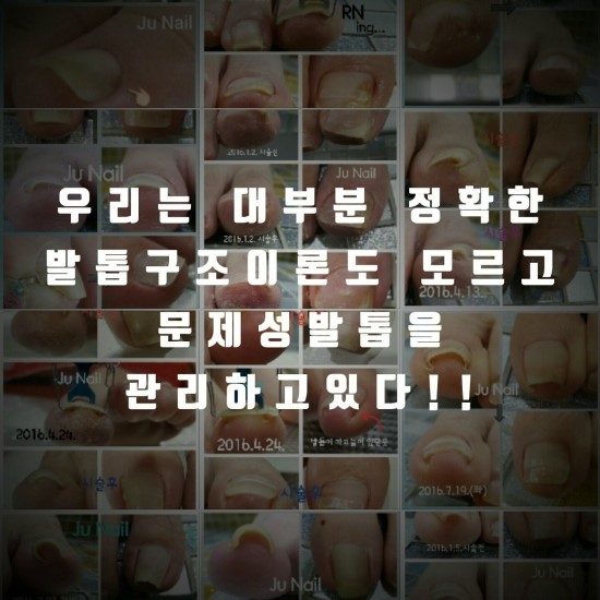 손발톱구조세미나/분당용인수원수지동백보정죽전동/주네일/파고드는발톱 손발톱구조세미나/분당용인수원수지동백보정죽전동/주네일/파고드는발톱