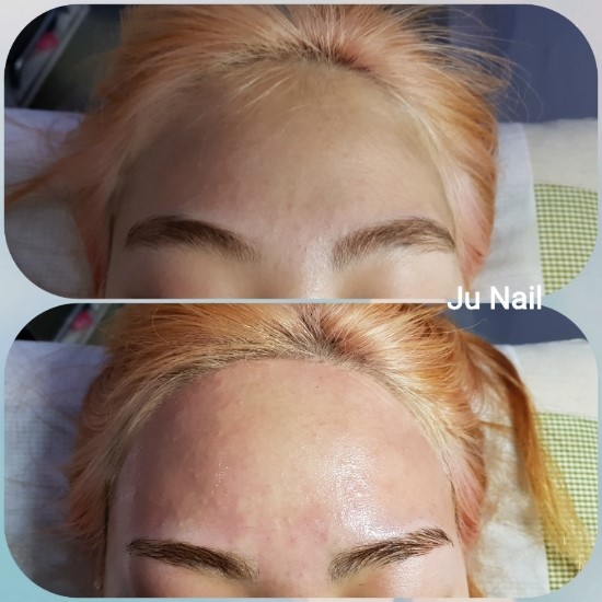 헤어라인이마왁싱/분당용인수원수지동백보정죽전동/주네일 헤어라인이마왁싱/분당용인수원수지동백보정죽전동/주네일