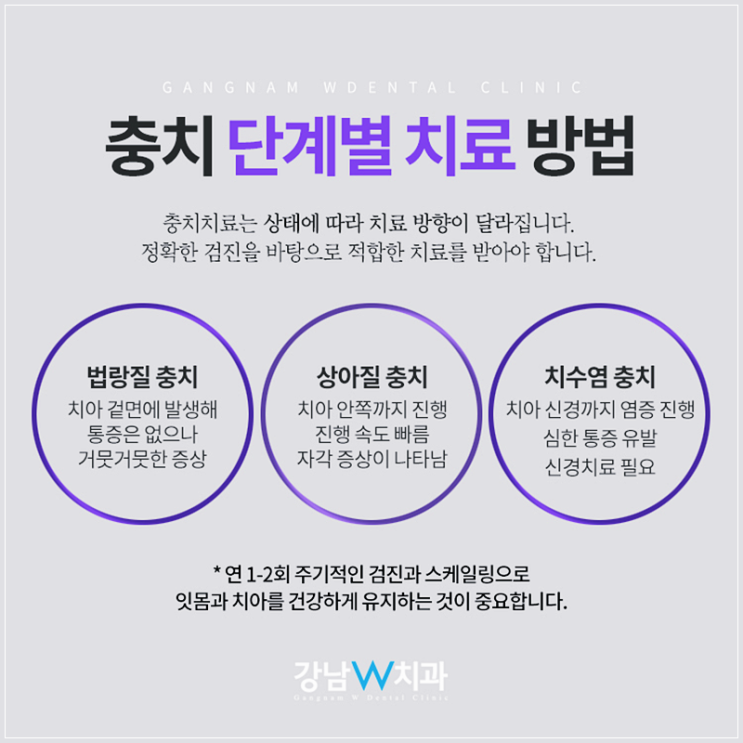 신논현역 충치치료제 가격캠페인 11