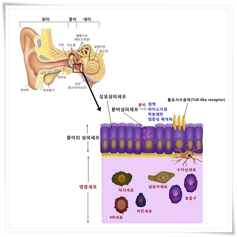 Acute otitismedia, 급성중이염의 원인, 증상, 치료 7