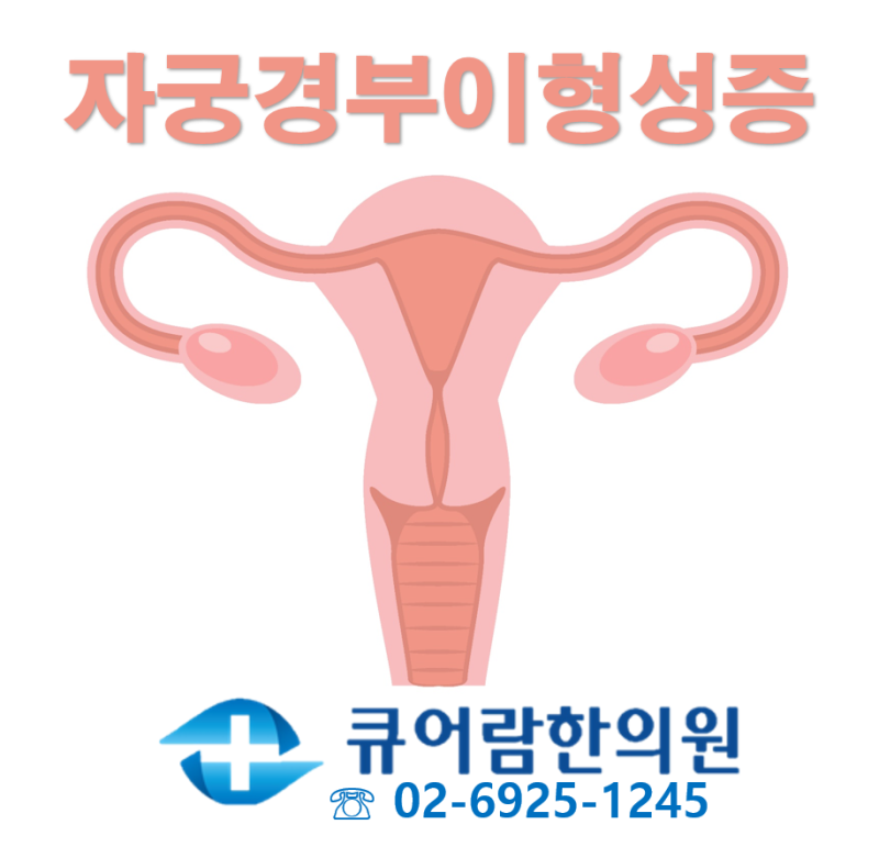 자궁경부이형성증의 원인과 증상, 자궁암의 전 단계라고? 11
