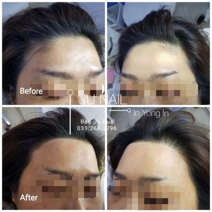 이마왁싱/분당용인수원수지동백보정동죽전동/주네일 이마왁싱/분당용인수원수지동백보정동죽전동/주네일