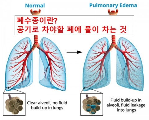  강아지폐수종증상/강아지폐수종기절/강아지심장병기절/노령견기절