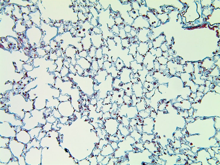  Masson's Trichrome stain
