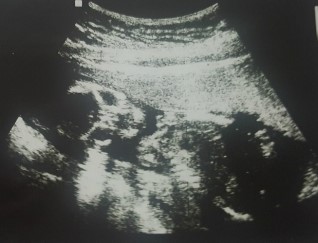 임신 16주