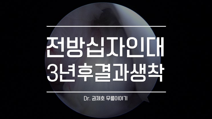  전방십자인대 재건술 3년 결과