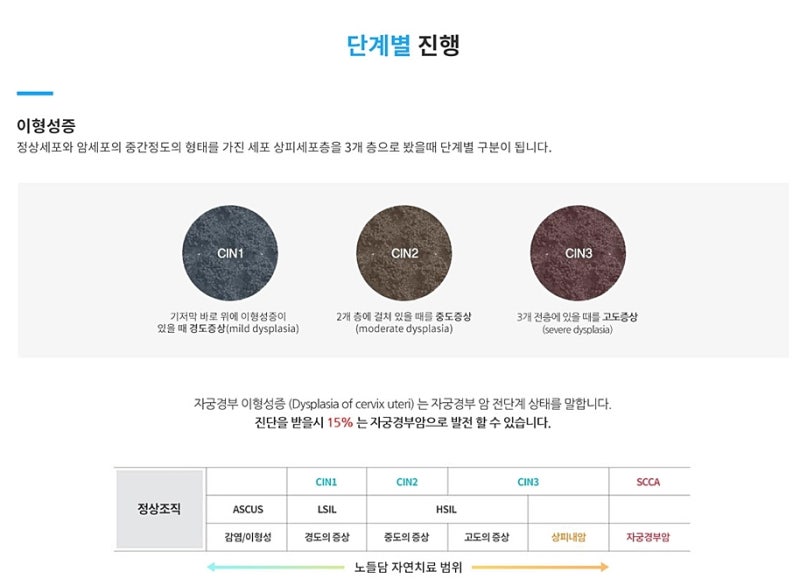 자궁경부이형성증 증상의 근본 원인을 해결하는 면역치료 7