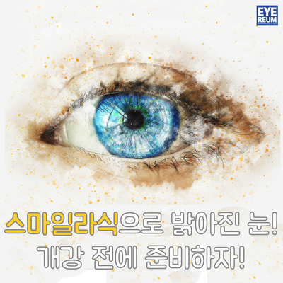 스마일라식으로 밝아진 눈! 개강 전에 준비하자!