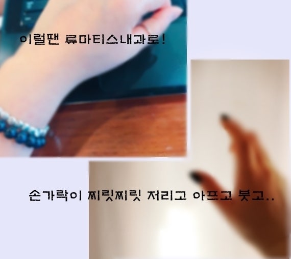 새끼 손가락에 저림과 마디 마다 통증이 느껴지는 이유 4