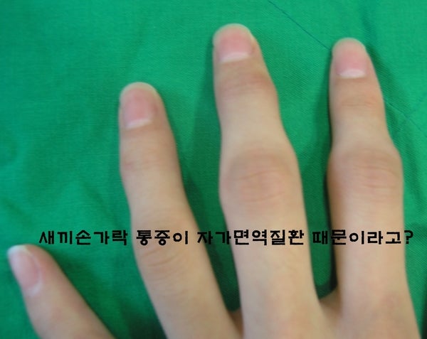 새끼 손가락에 저림과 마디 마다 통증이 느껴지는 이유 3