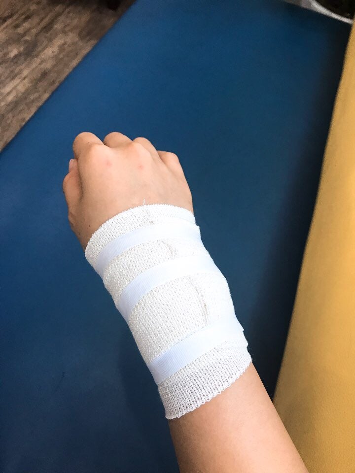 손목결절종 수술 대신 손목보호대로 나은 후기 10