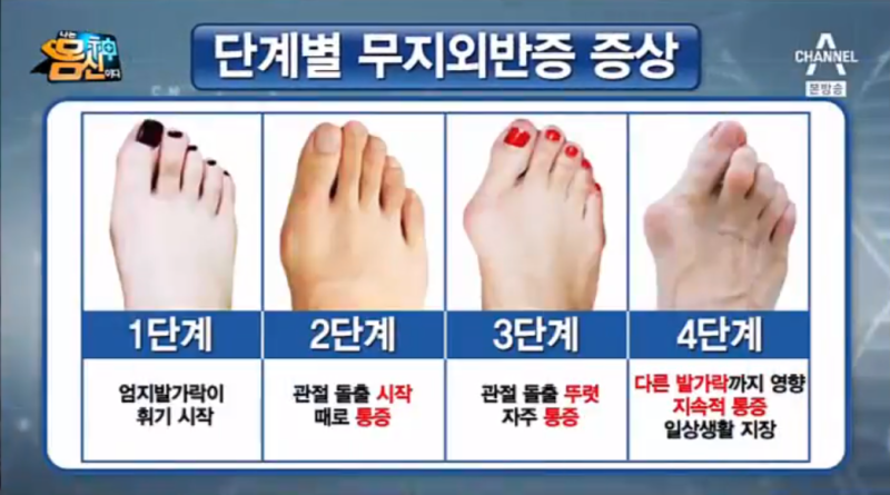 오른발 통증이 계속 보일 때 5