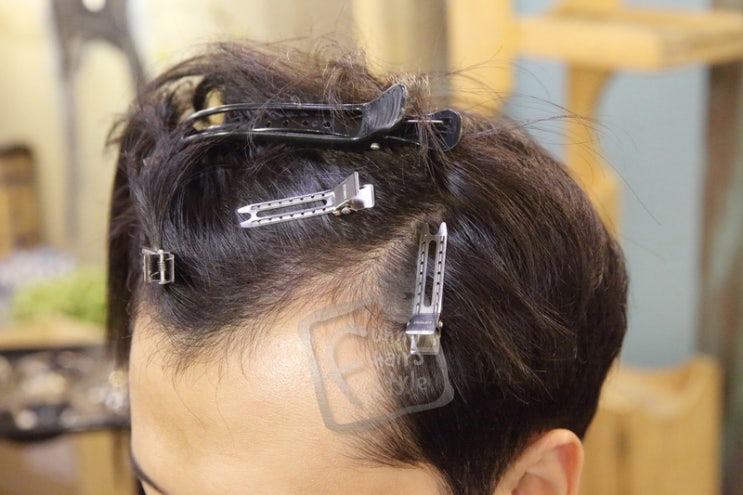  남자 앞머리 탈모 T 퍼니 테이프 스티커 붙임머리 증모 스타일