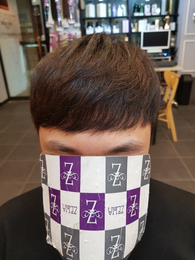 앞머리탈모 고민도 대구증모술 전문 젤리아헤어 남성연장 4