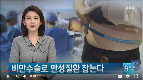 '비만 수술비'에 건강보험 적용 예정…만성질환 잡는다 - SBS뉴스 '비만 수술비'에 건강보험 적용 예정…만성질환 잡는다 - SBS뉴스