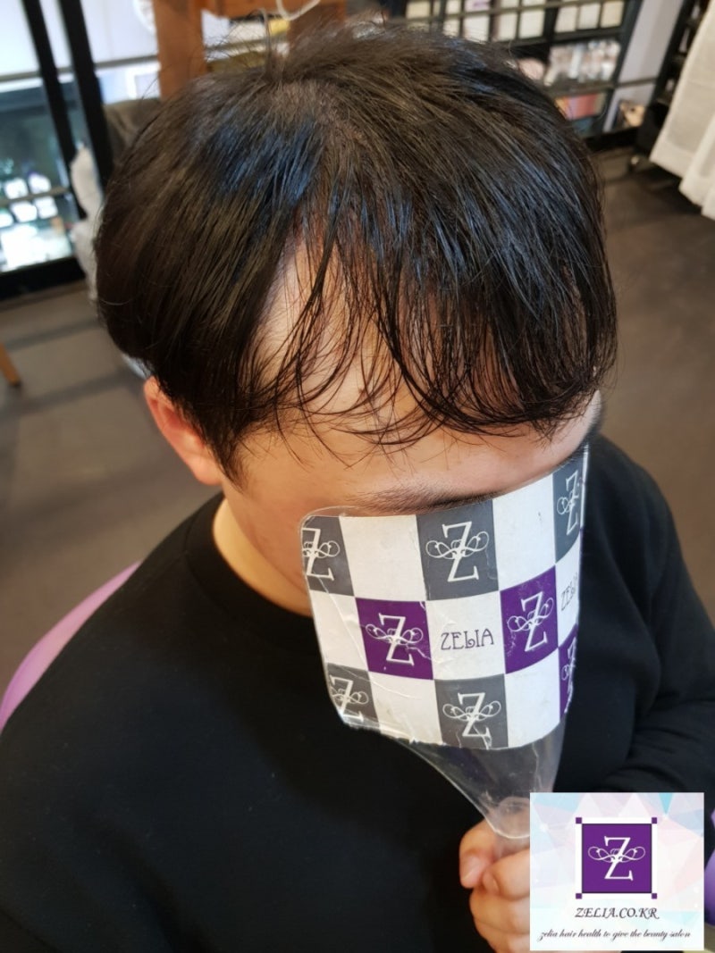 앞머리탈모 고민도 대구증모술 전문 젤리아헤어 남성연장 3
