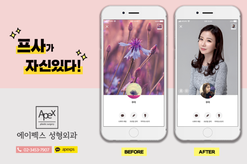 에이펙스성형외과 성형 후 자신감!