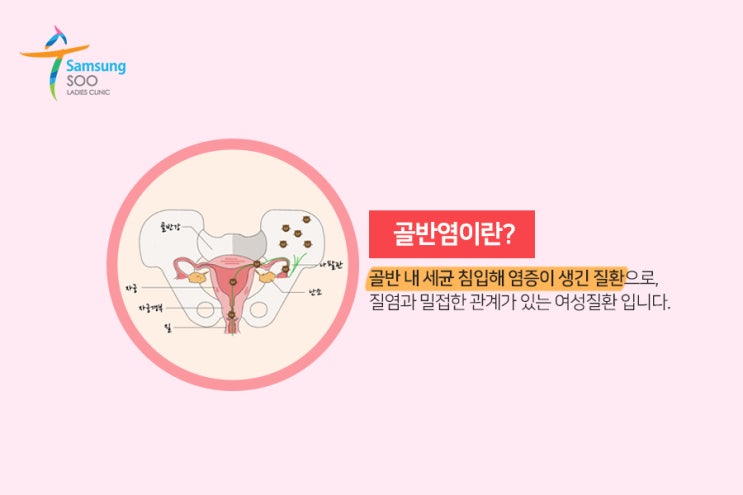 골반염 원인 및 통증 증상 검사 후 치료 방법 까지 4