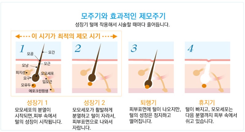 수원 레이저 탈모 받기 전 알아야 할 핵심 1가지