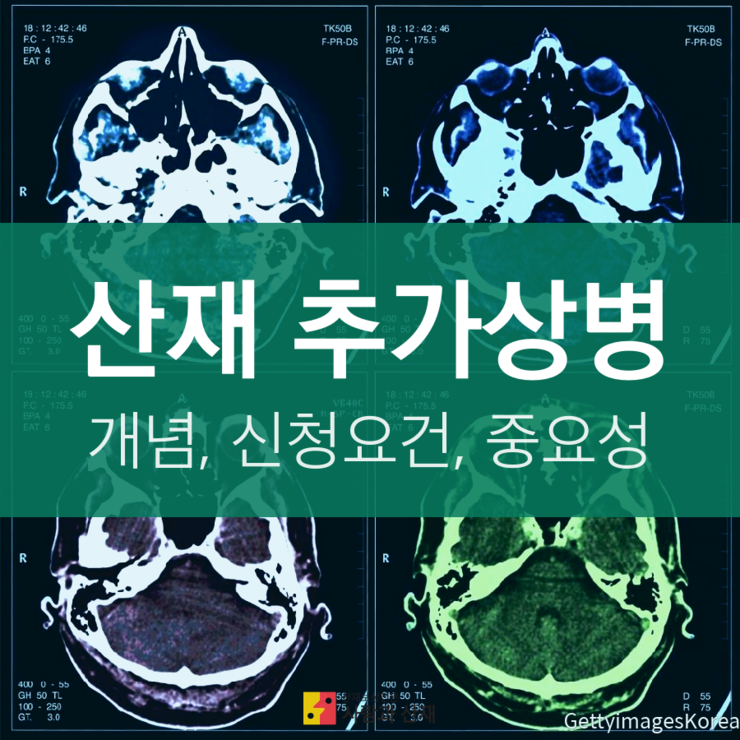  [추가상병] 산재 추가상병 요양급여 신청