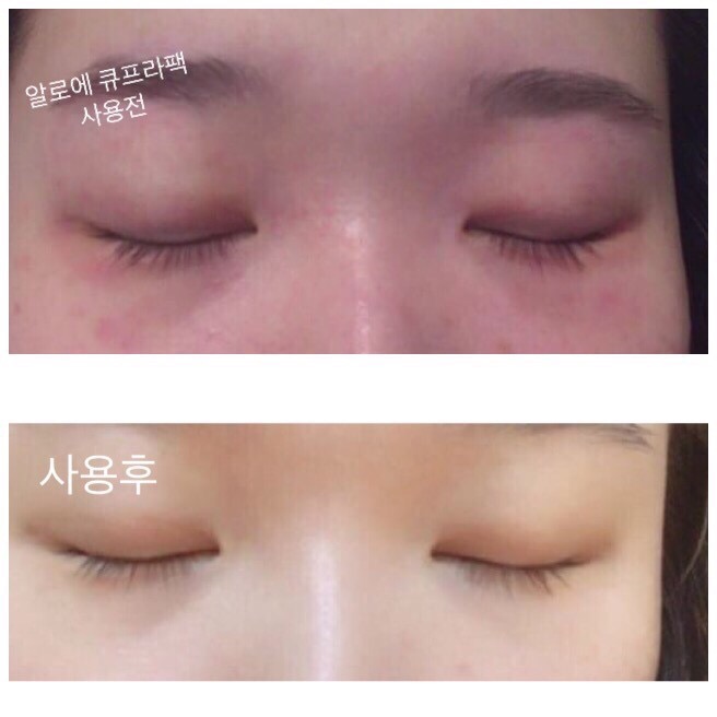  [제플뷰티] [3월플랜]3달만에 다른마스크팩쓰다가도 돌아온다는  #큐프라팩 / 파랭이 깜짝 공구  /수분마스크팩 / 마스크팩추천