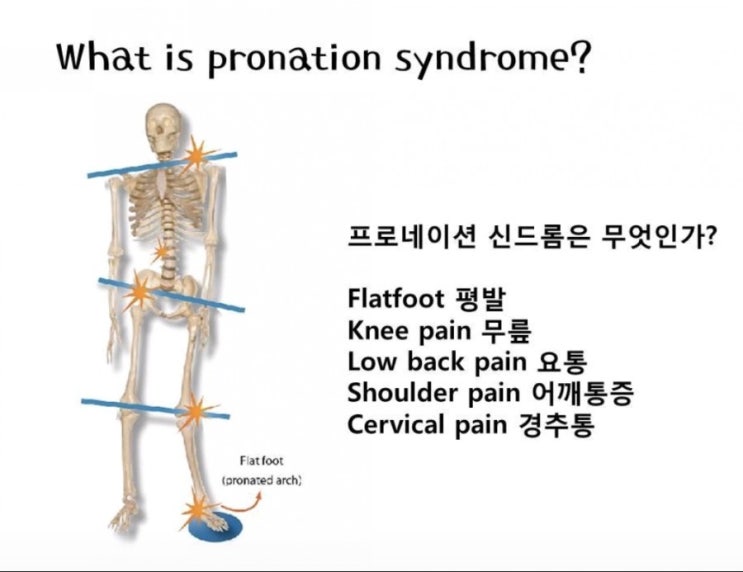  [바른몸 연구소/코리고] 교정의 지름길