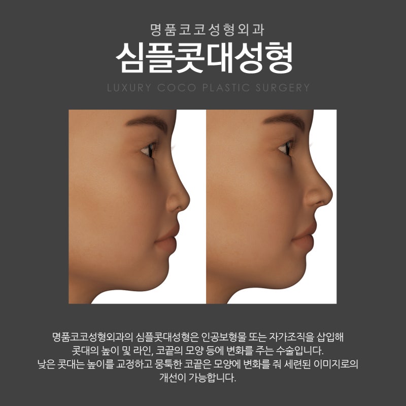 코수술비용 책임감을 가진후 5