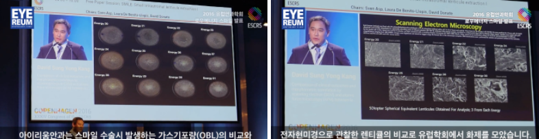 군인스마일라식 A to Z 전격 공개!