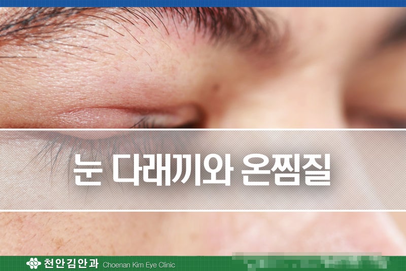 눈이 건조할 때 손목이 아플 때 더 진심으로 찜질(온찜질, 냉찜질 가능) 4