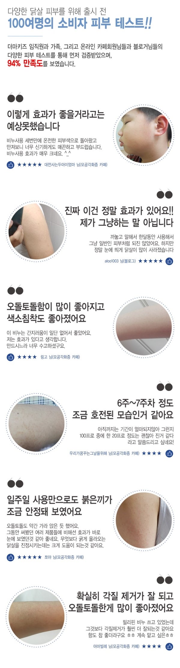 각화증 필라리스 크림 비누 솔직후기