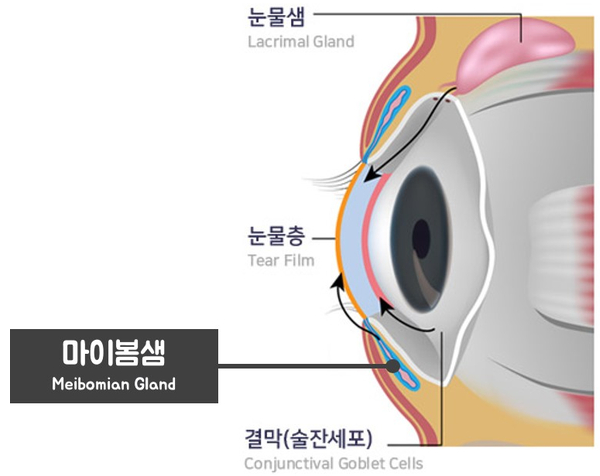 안구건조증  IPL 레이저치료로 극복!