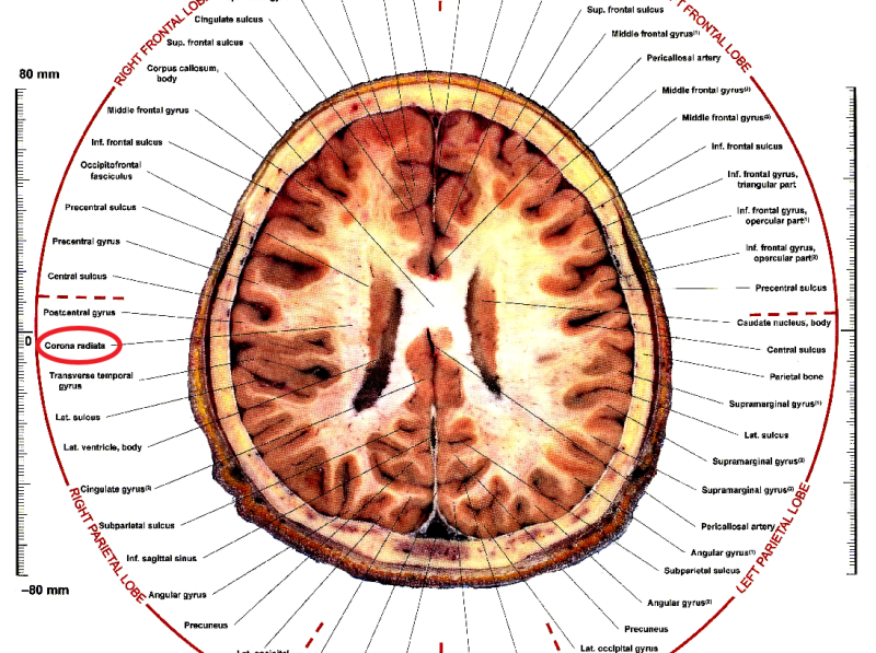 Corona radiata :corticopontine tract, the corticobulbar tract, and the ...